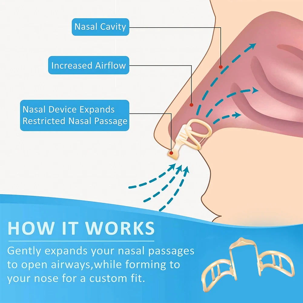 Nasal Dilator Snore Stopper – Silicone Nose Clip for Better Sleep