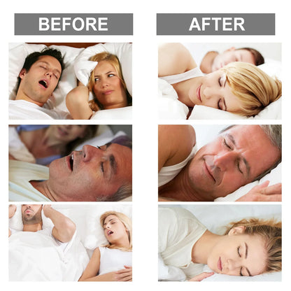 Anti Snoring Mouth Guard - Stop Snoring, Teeth Grinding Solution