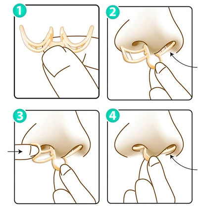 Nasal Dilator Snore Stopper – Silicone Nose Clip for Better Sleep