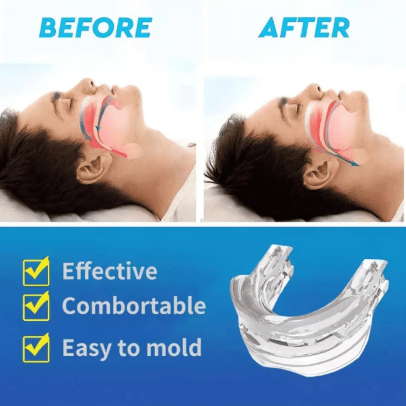 Anti Snoring Mouth Guard - Stop Snoring, Teeth Grinding Solution