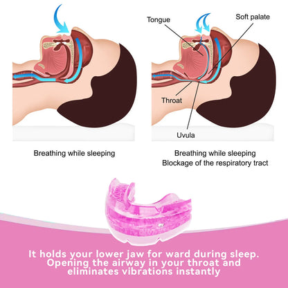 Anti Snore Mouth Guard for Bruxism and Sleep Apnea Relief