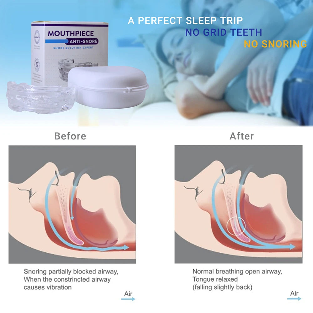 Anti Snoring Mouth Guard for Better Sleep - Snore Solution Device