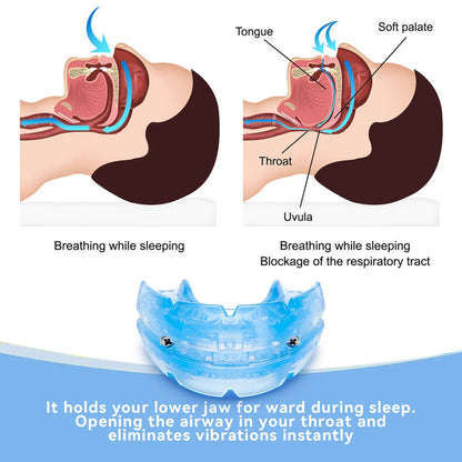 Adjustable Anti-Snoring Mouth Guard - Improve Sleep Comfortably