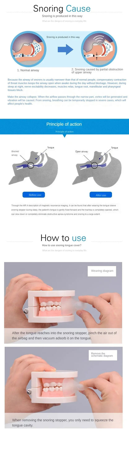 Anti Snoring Mouth Guard - Stop Snoring, Teeth Grinding Solution