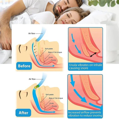 Anti-Snore Nose Clip - Effective Snoring Solution for Men