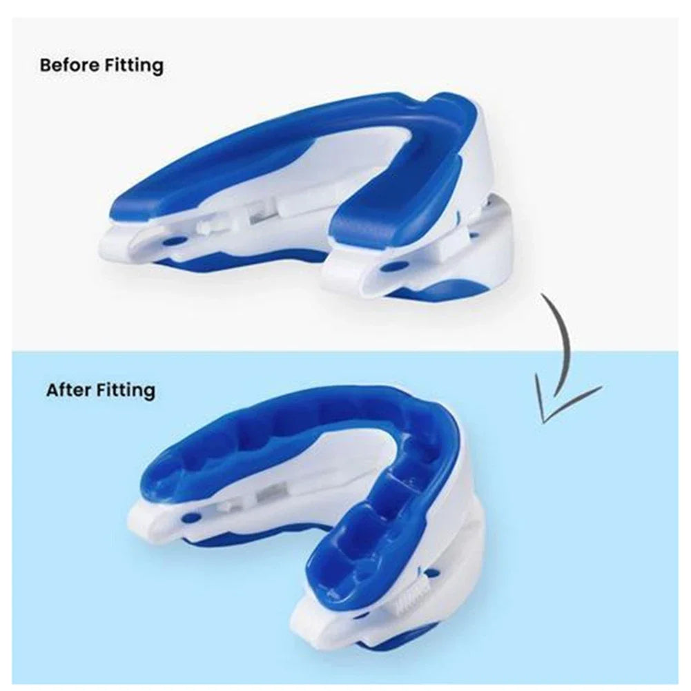 Anti-Snoring Mouthpiece - Adjustable Jaw & Custom Fit Guard