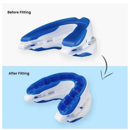 Anti-Snoring Mouthpiece - Adjustable Jaw & Custom Fit Guard